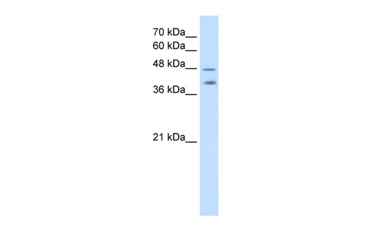 Antibody used in WB on Human NCI-H226 cells at 2.5 ug/ml.