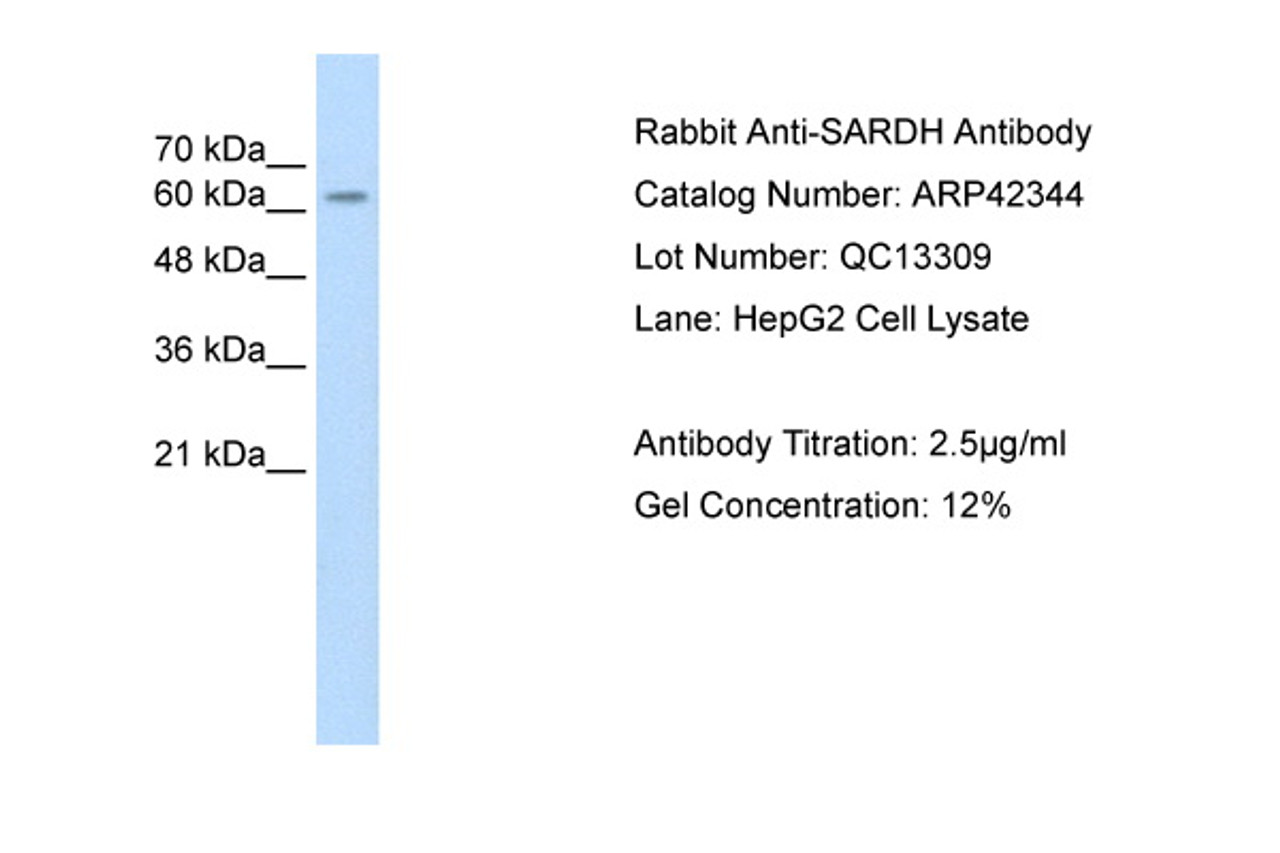 Antibody used in WB on Human HepG2 at 2.5 ug/ml.