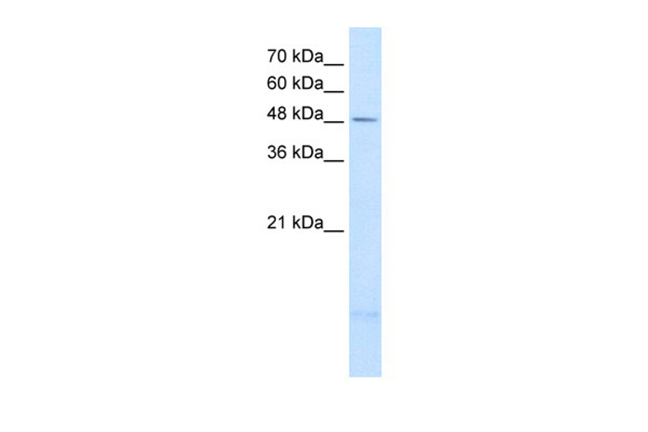 Antibody used in WB on Human A204 cells at 2.5 ug/ml.