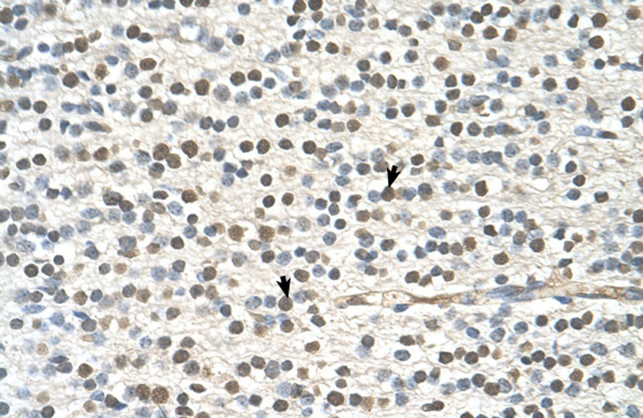 Antibody used in IHC on Human Brain.