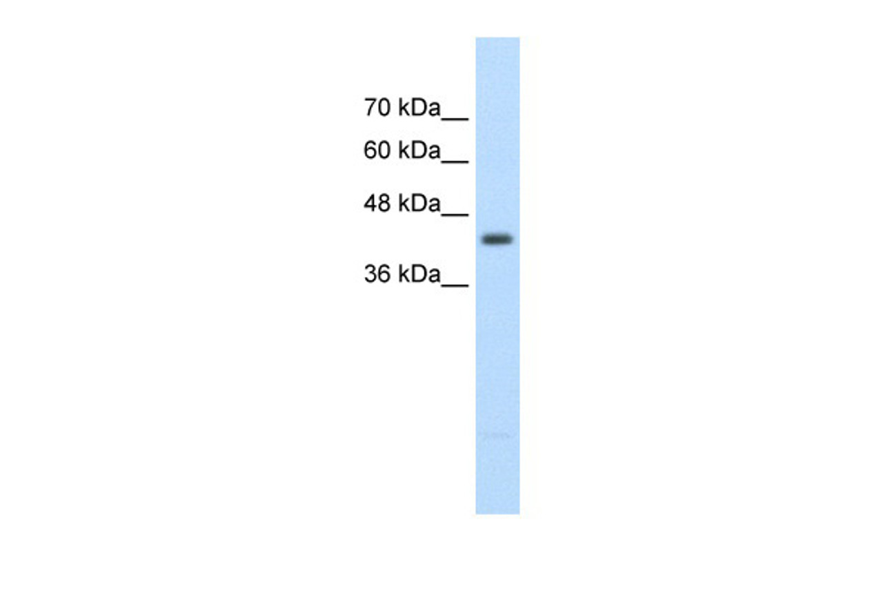 Antibody used in WB on Human Jurkat 2.5 ug/ml.