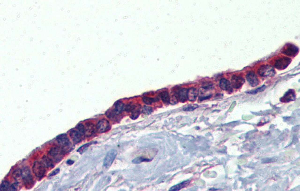 Antibody used in IHC on Human Lung at 5.0 ug/ml.