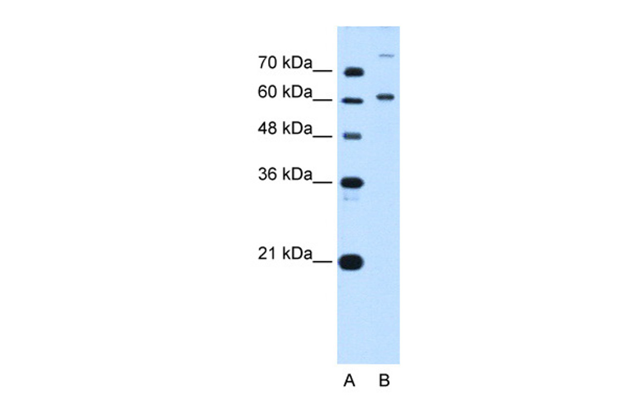 Antibody used in WB on Human HepG2 at 5.0 ug/ml.