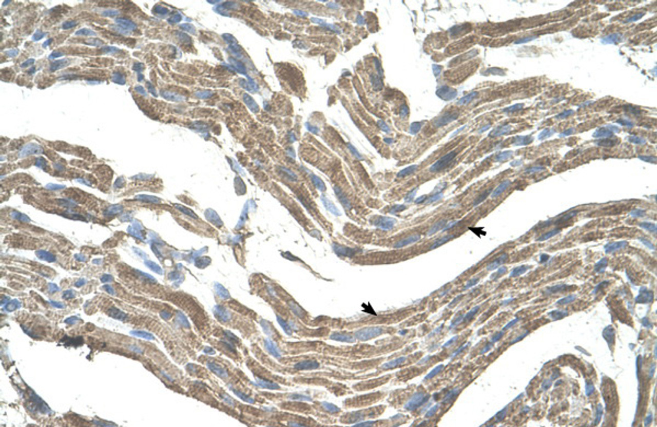 Antibody used in IHC on Human Muscle.