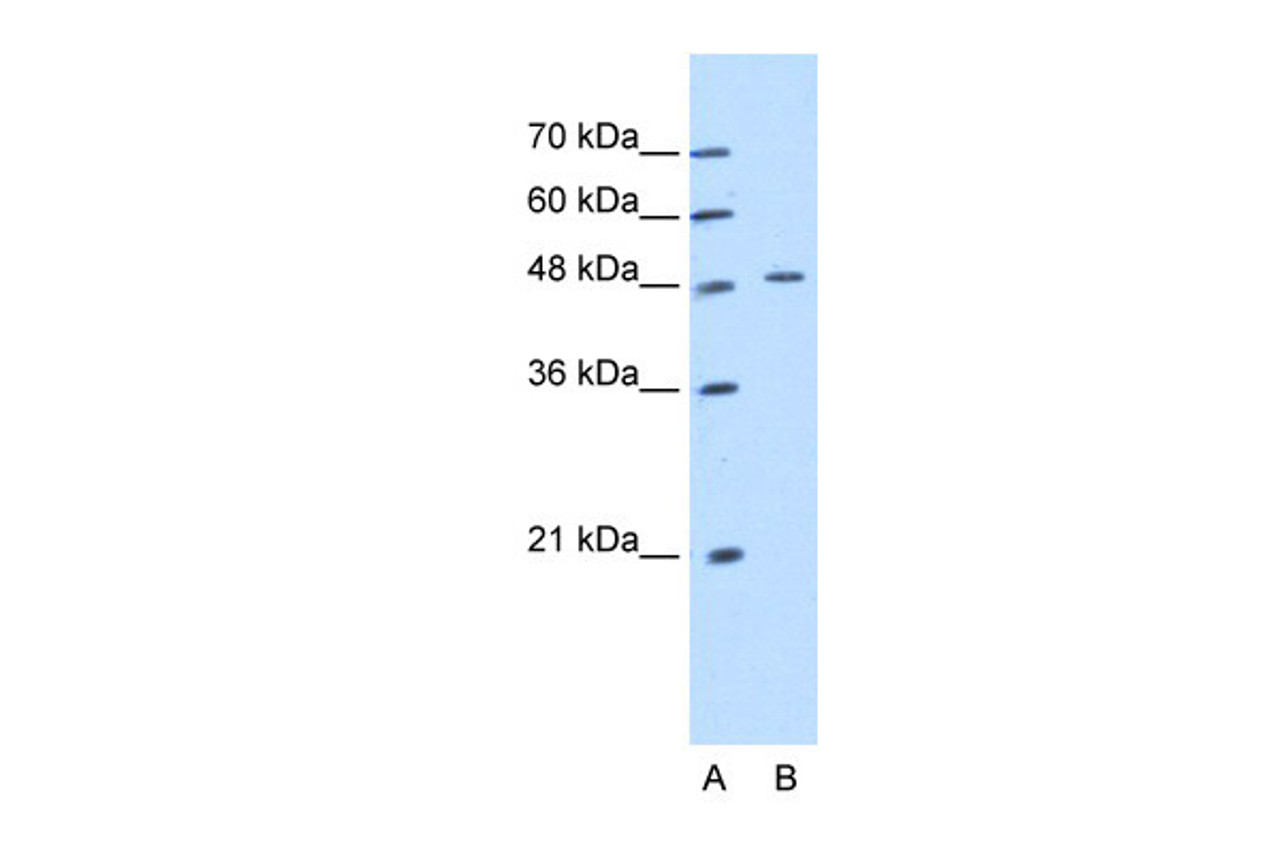 Antibody used in WB on Human DLD1 at 1.25 ug/ml.