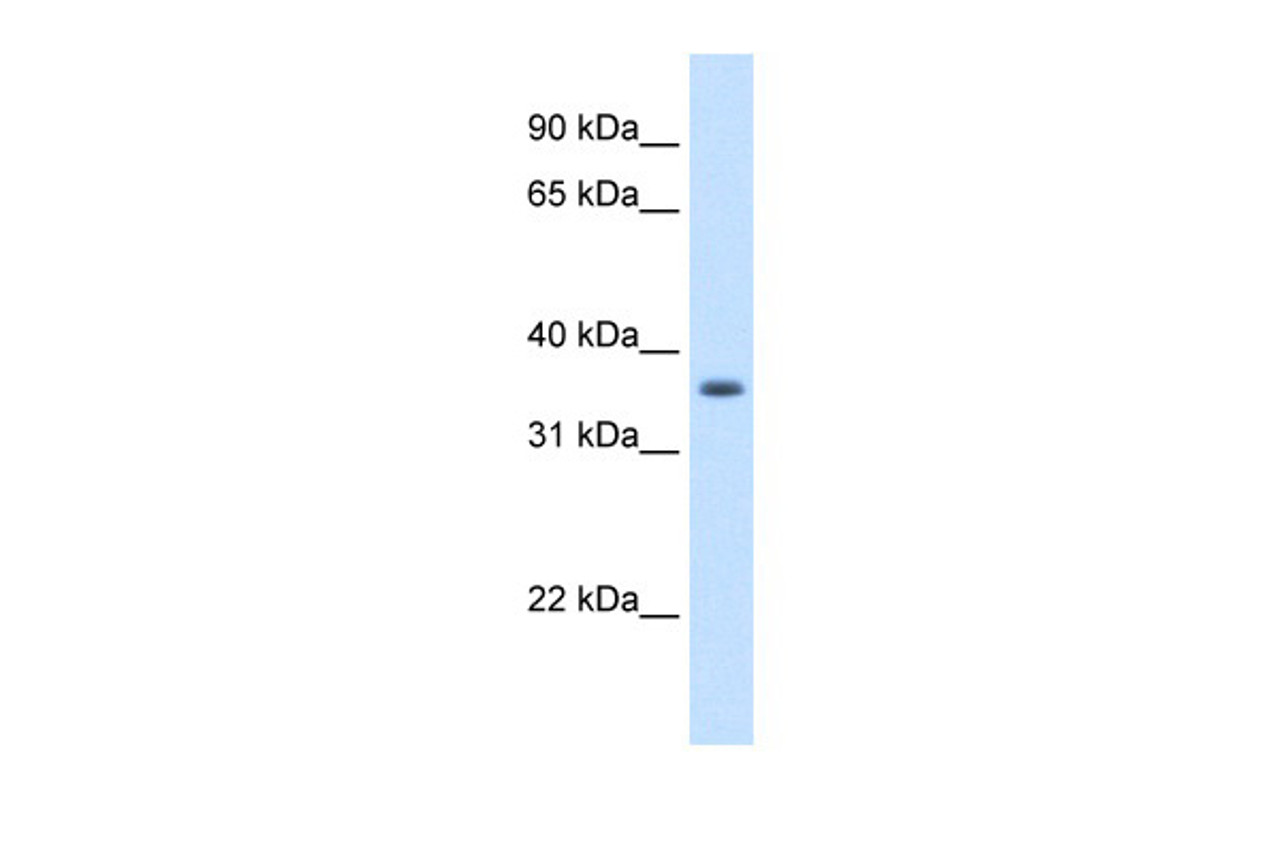 Antibody used in WB on Human A549 at 1.25 ug/ml.