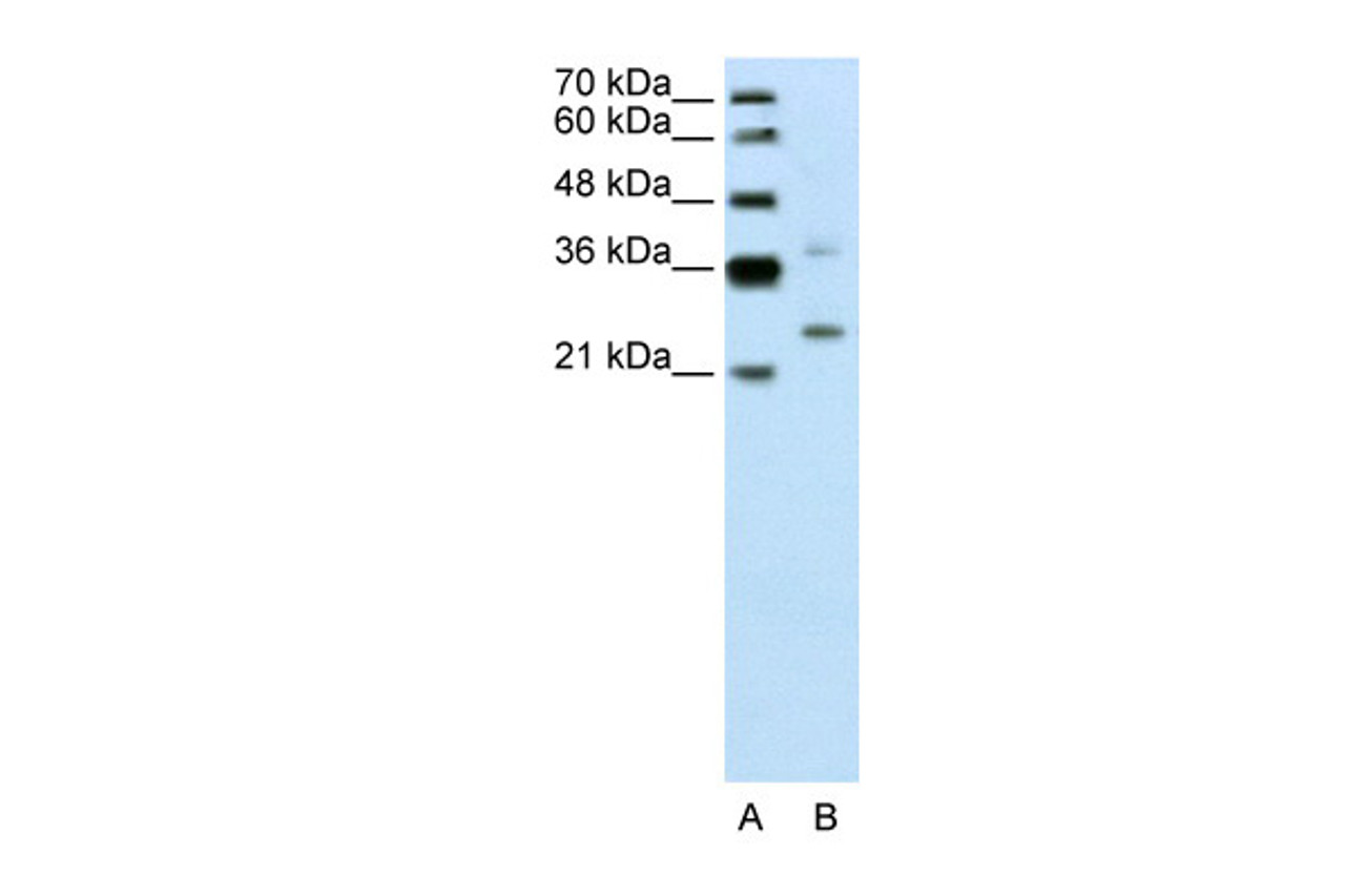 Antibody used in WB on Human Jurkat 0.2-1 ug/ml.