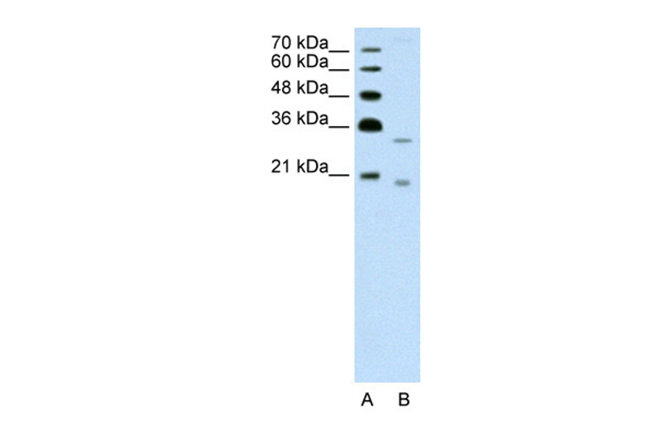 Antibody used in WB on Human Jurkat 1.25 ug/ml.