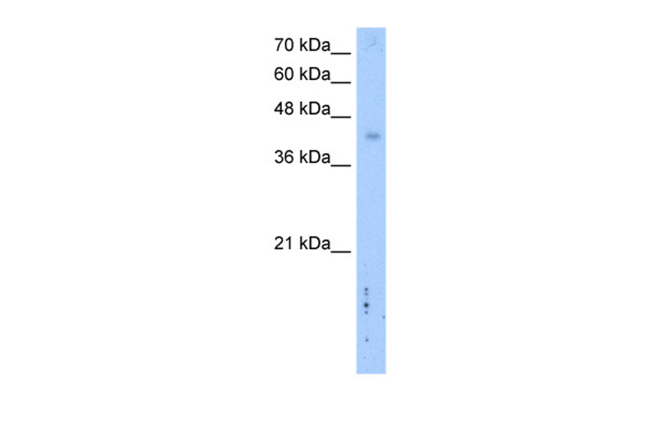 Antibody used in WB on Transfected 293T at 2.5 ug/ml.