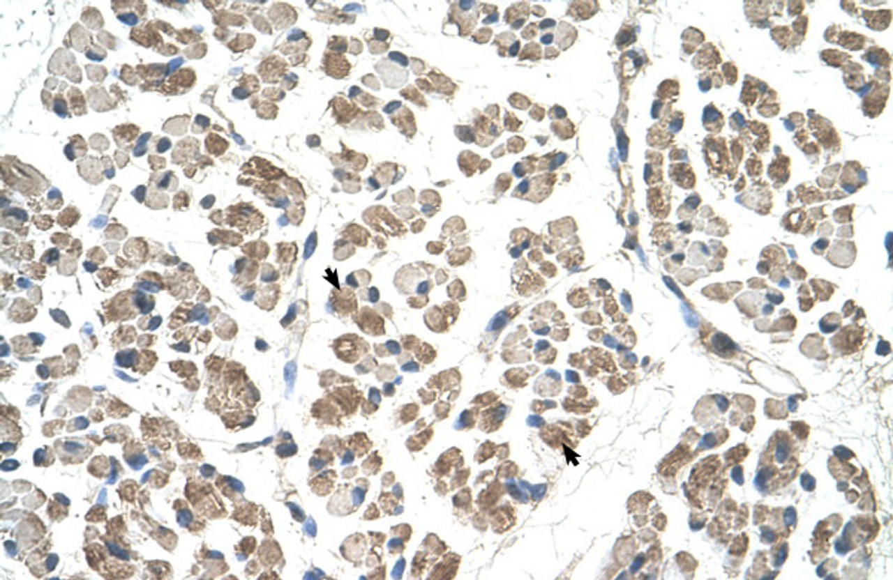 Antibody used in IHC on Human Muscle.