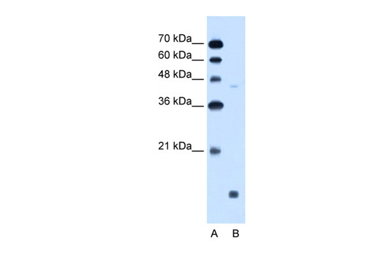 Antibody used in WB on Human Jurkat 0.2-1 ug/ml.