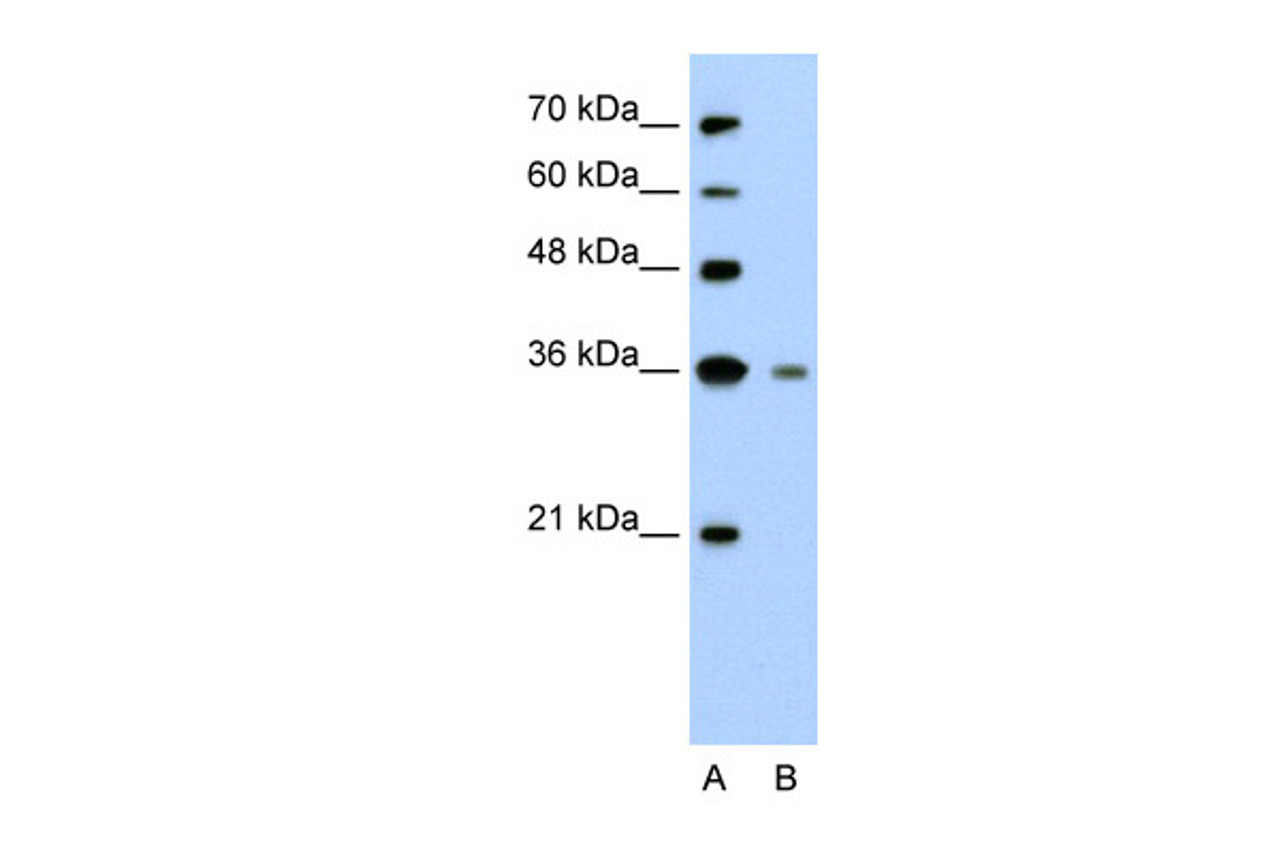 Antibody used in WB on Human Jurkat 2.5 ug/ml.