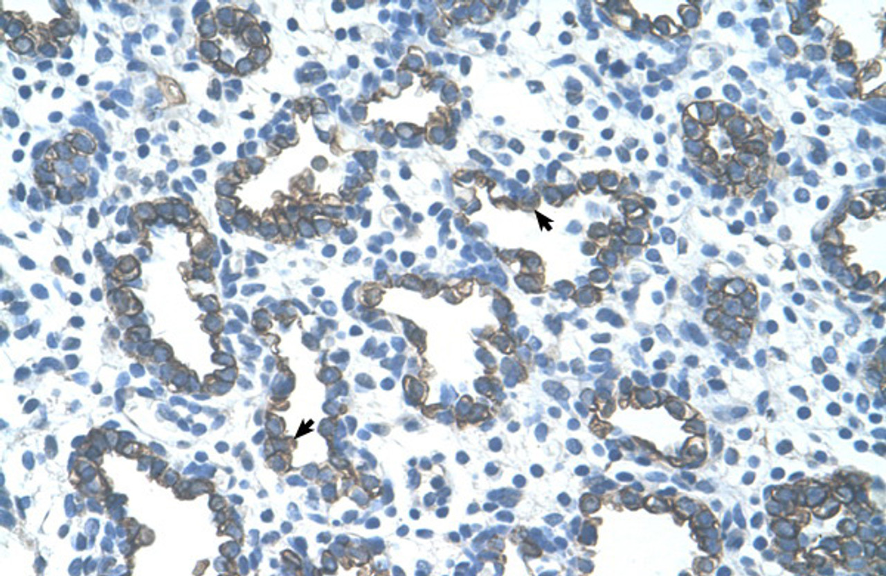 Antibody used in IHC on Human Lung.