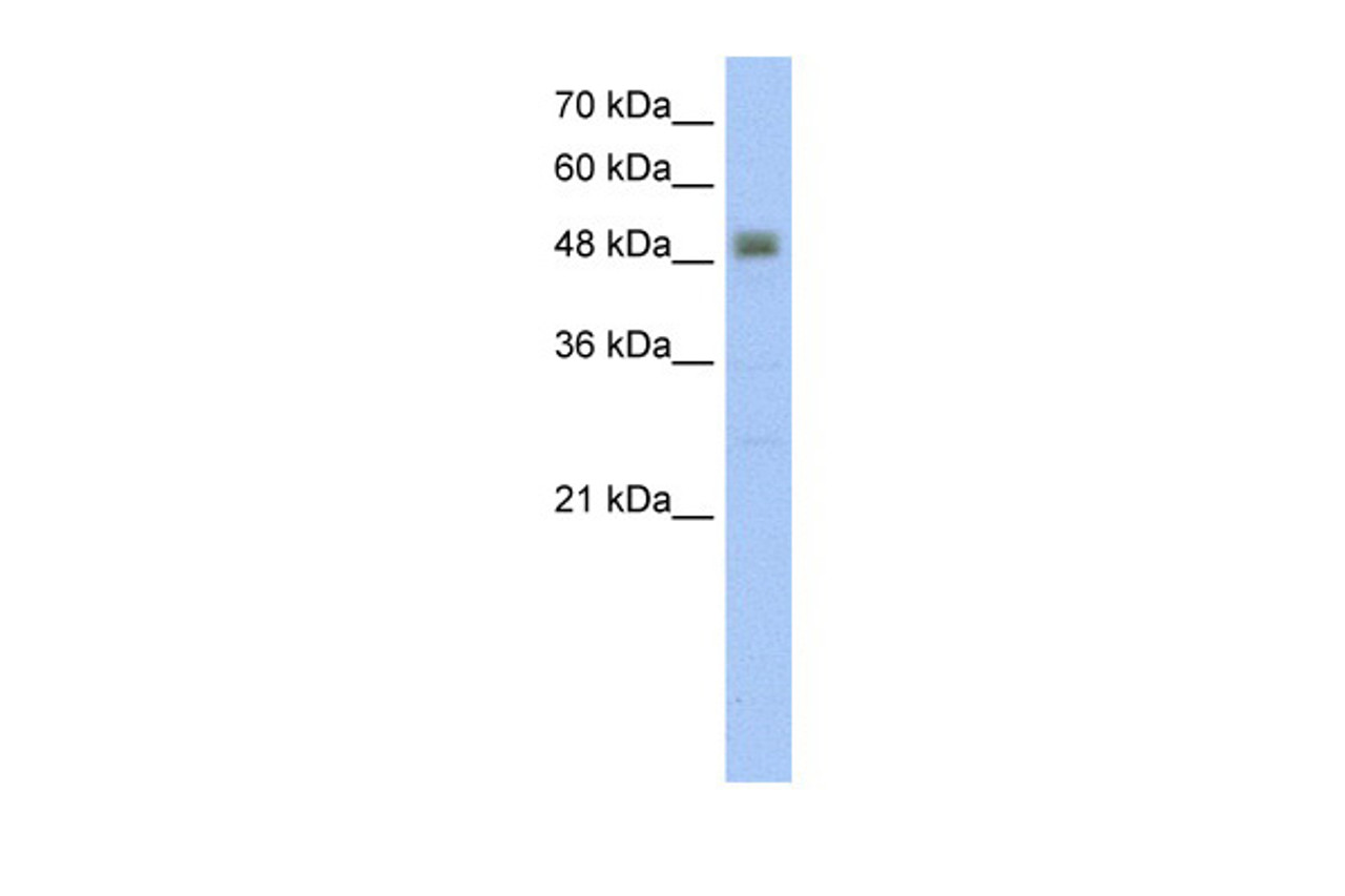 Antibody used in WB on Human Jurkat 5.0 ug/ml.