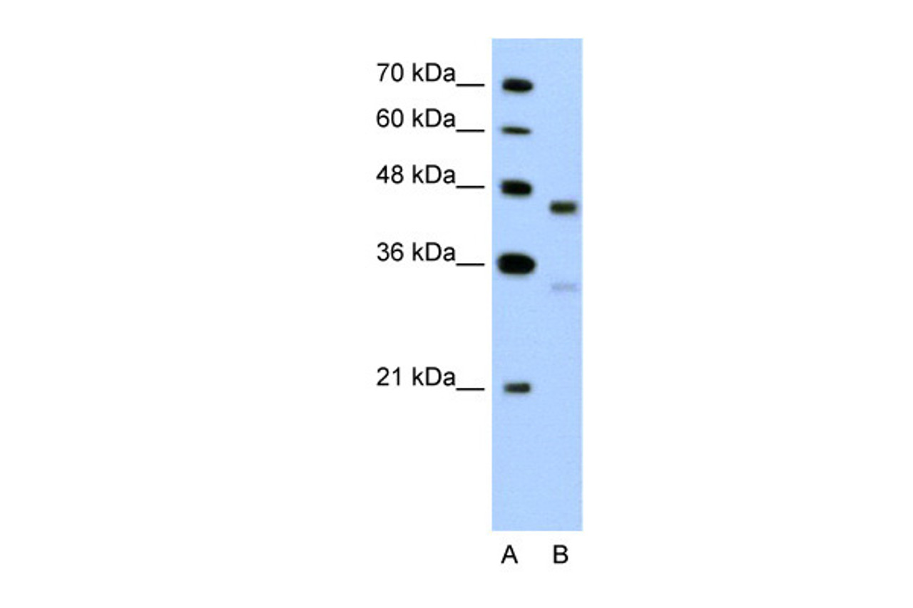 Antibody used in WB on Human HepG2 at 5.0 ug/ml.