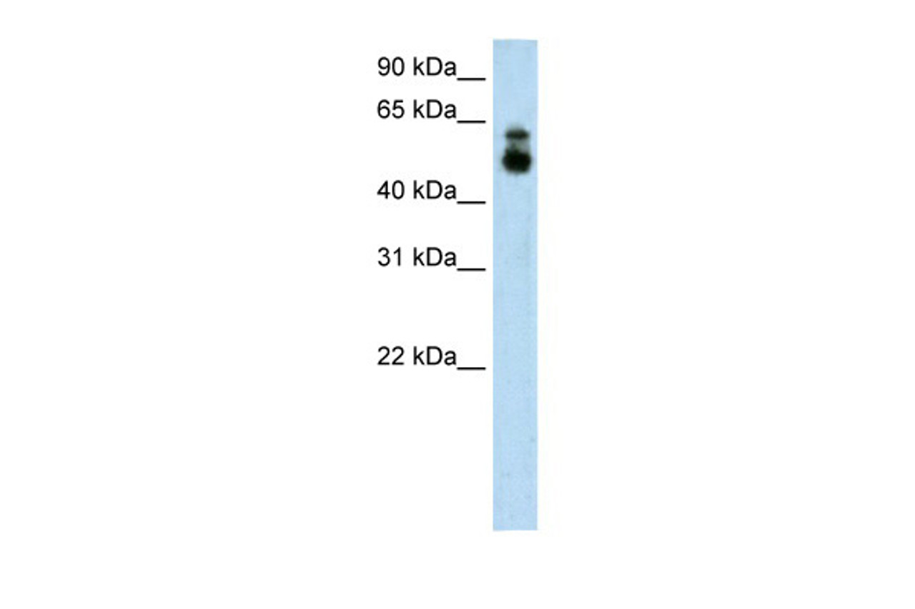 Antibody used in WB on Human A172 at 1.25 ug/ml.