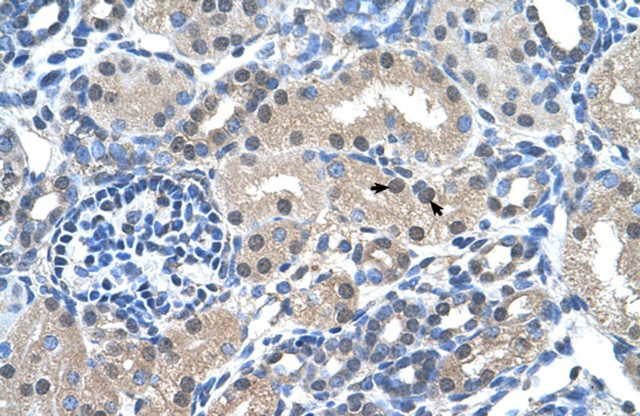 Antibody used in IHC on Human kidney.