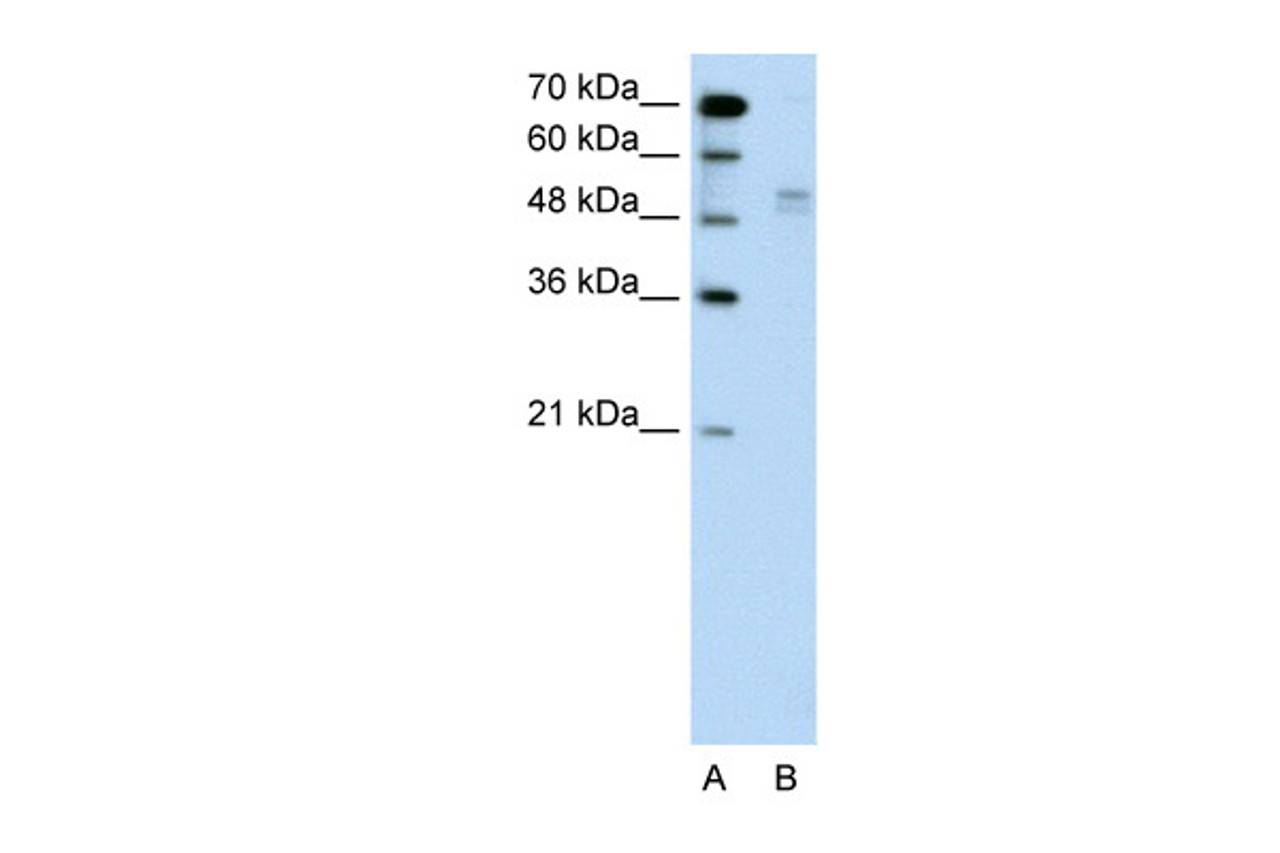 Antibody used in WB on Human Jurkat 0.2-1 ug/ml.