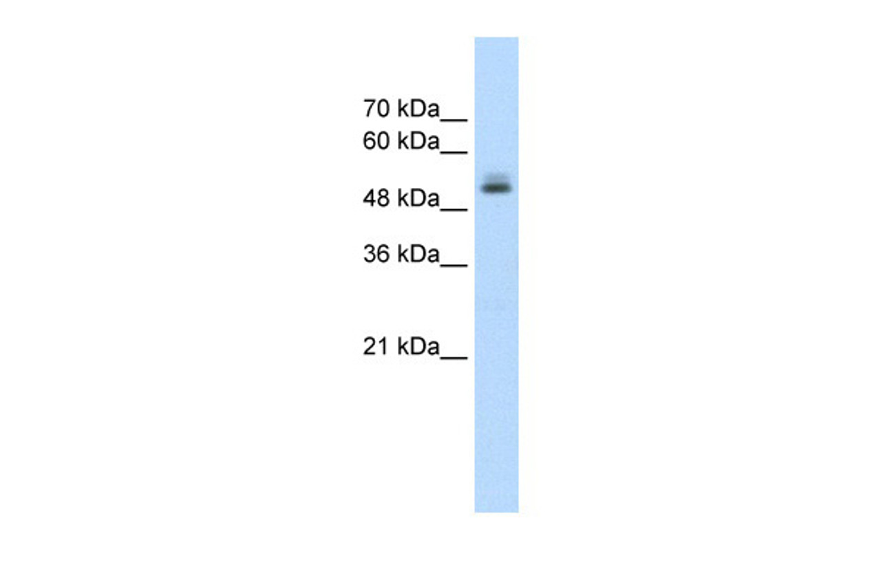 Antibody used in WB on Human HepG2 at 1.25 ug/ml.