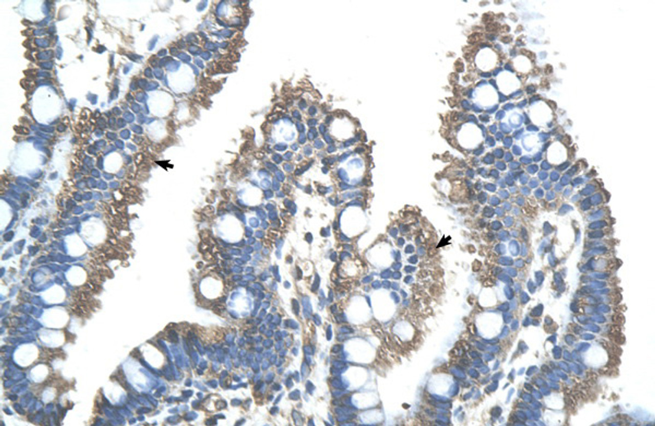 Antibody used in IHC on Human Intestine.