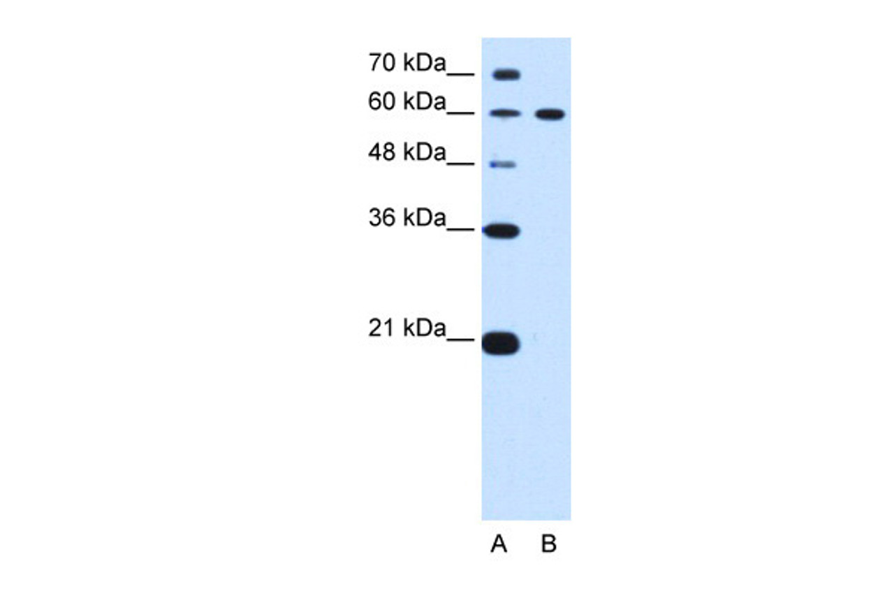 Antibody used in WB on Human HepG2 at 0.2-1 ug/ml.