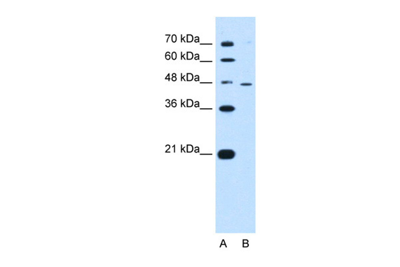 Antibody used in WB on Human HepG2 at 0.5 ug/ml.