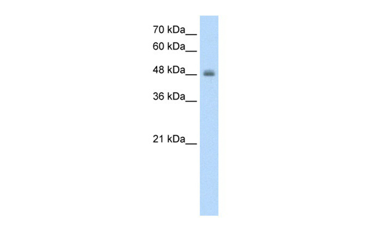 Antibody used in WB on Human HepG2 at 1.25 ug/ml.