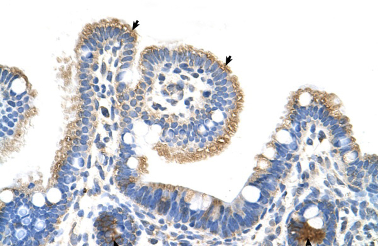 Antibody used in IHC on Human Intestine.