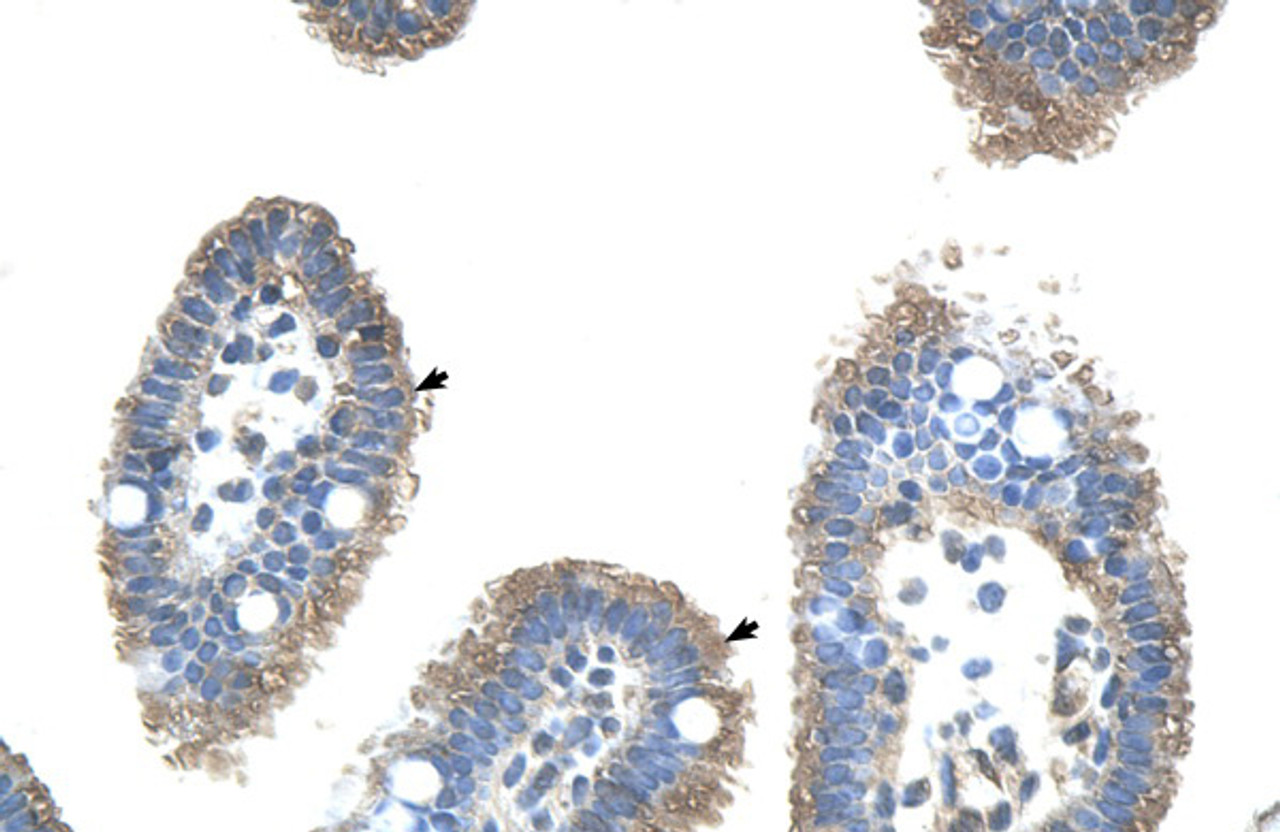 Antibody used in IHC on Human Intestine.