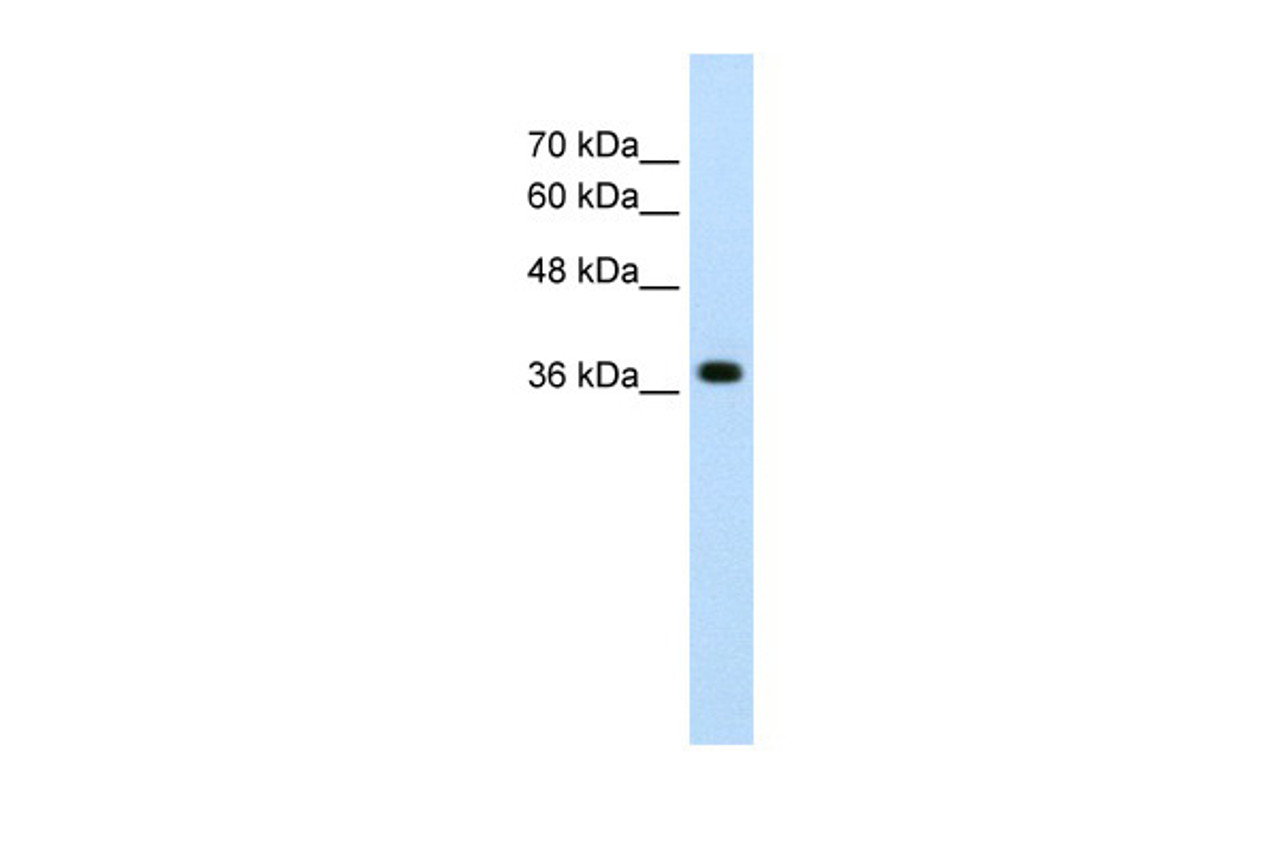 Antibody used in WB on Human HepG2 at 2.5 ug/ml.