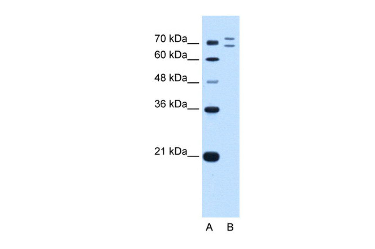 Antibody used in WB on Human HepG2 at 0.5 ug/ml.