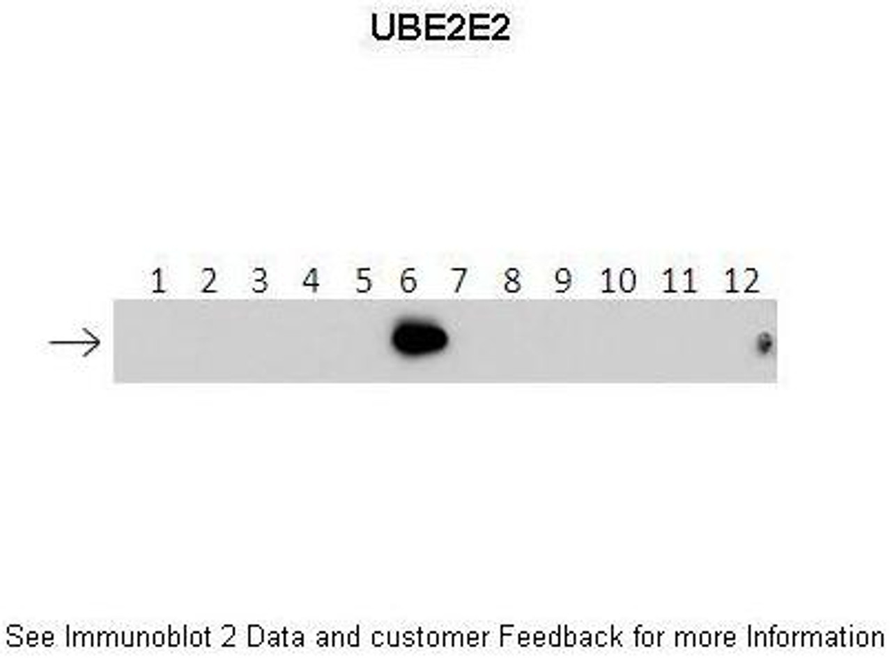 Antibody used in WB on recombinant protein at: 1:500 (Lanes: 1: 40ng HIS-UBE2D1 protein, 2: 40ng HIS-UBE2D2 protein, 3: 40ng HIS-UBE2D3 proteinm, 4: 40ng HIS-UBE2D4 protein, 5: 40ng HIS-UBE2E1 protein, 6: 40ng HIS-UBE2E2 protein, 7: 40ng HIS-UBE2E3 protein, 8: 40ng HIS-UBE2K protein, 9: 40ng HIS-UBE2L3 protein, 10: 40ng HIS-UBE2N protein, 11: 40ng HIS-UBE2V1 protein, 12: 40ng HIS-UBE2V2 protein.) .