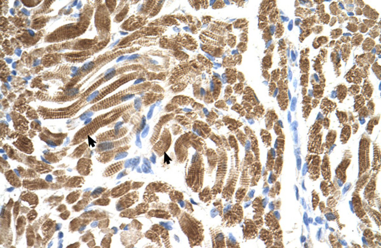 Antibody used in IHC on Human Muscle.