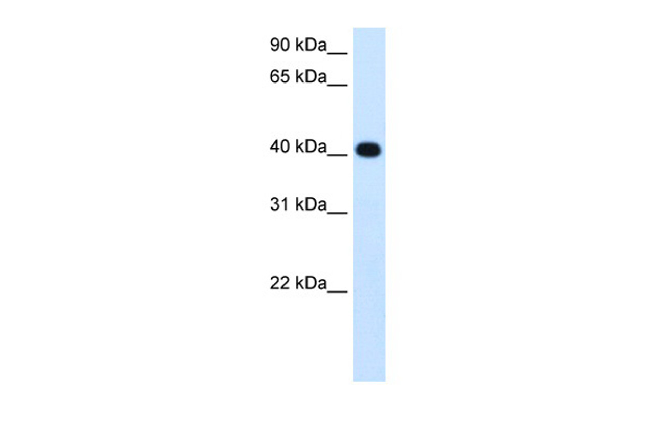 Antibody used in WB on Human Fetal liver at 1.25 ug/ml.