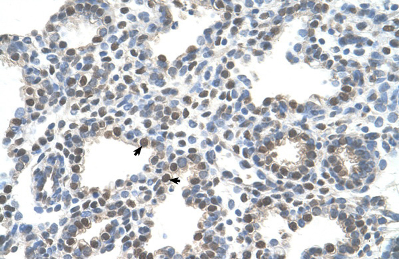 Antibody used in IHC on Human Lung.