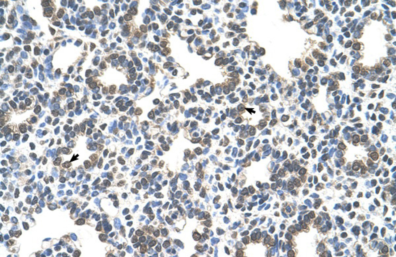 Antibody used in IHC on Human Lung.