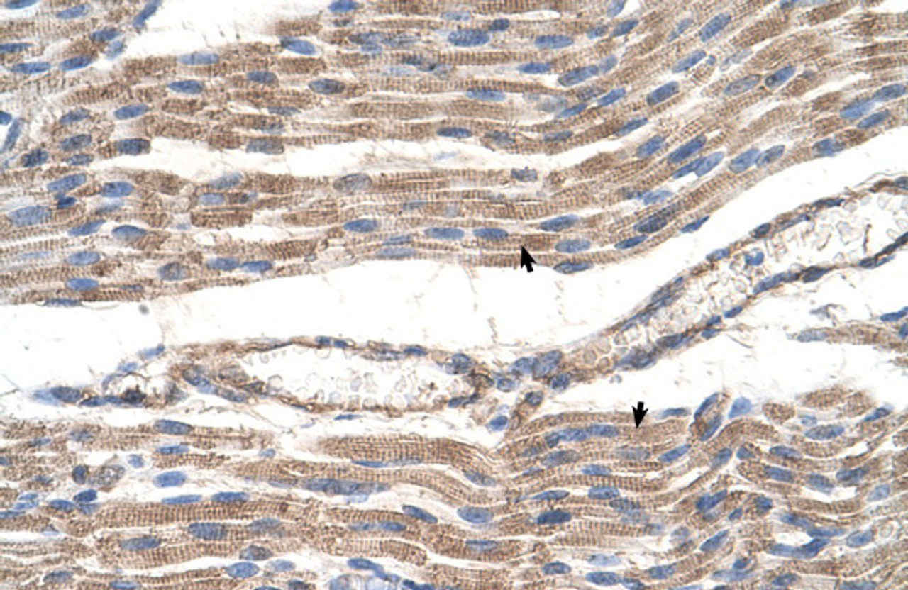 Antibody used in IHC on Human Muscle.