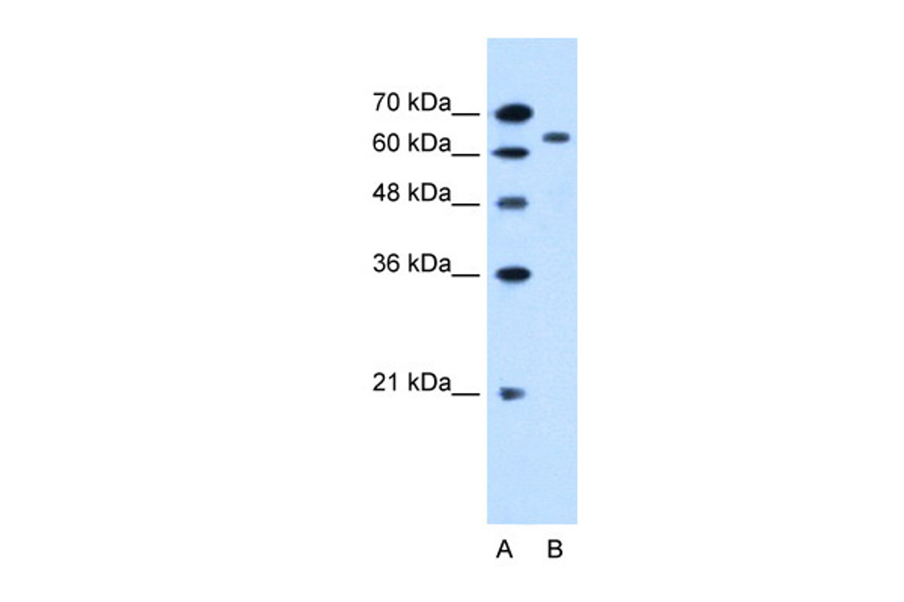 Antibody used in WB on Human HepG2 at 0.2-1 ug/ml.