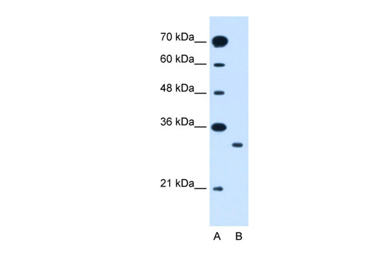 Antibody used in WB on Human Jurkat 1.25 ug/ml.