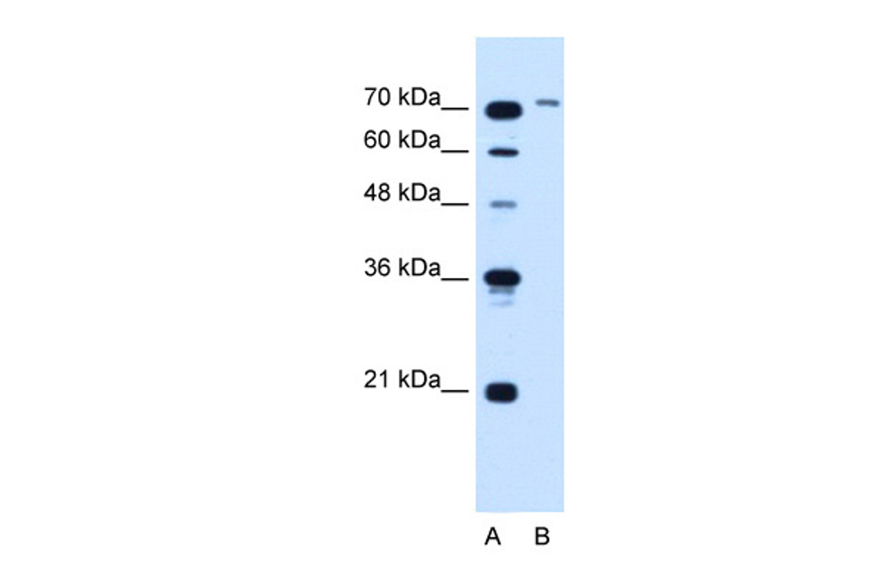 Antibody used in WB on Human Jurkat 5.0 ug/ml.