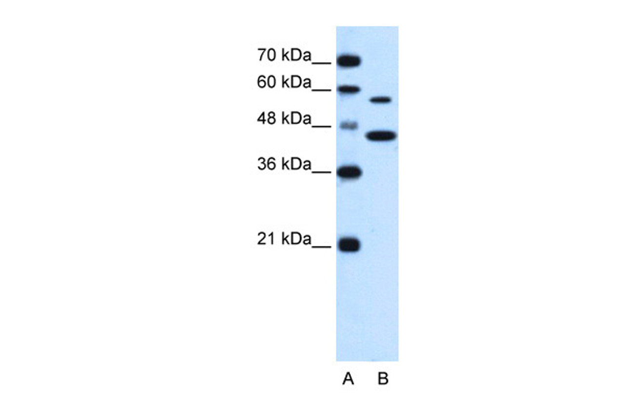 Antibody used in WB on Human HepG2 at 0.5 ug/ml.