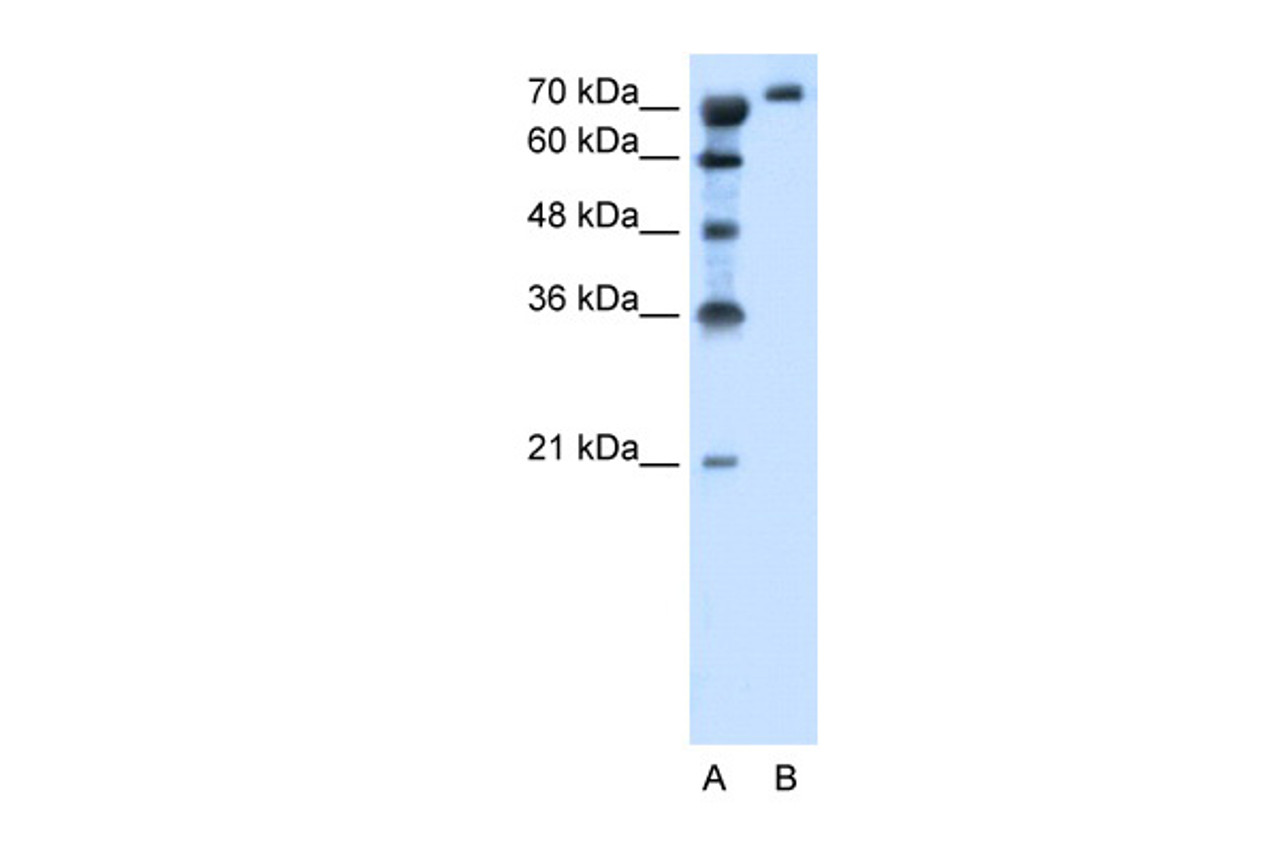 Antibody used in WB on Human Jurkat 1.25 ug/ml.