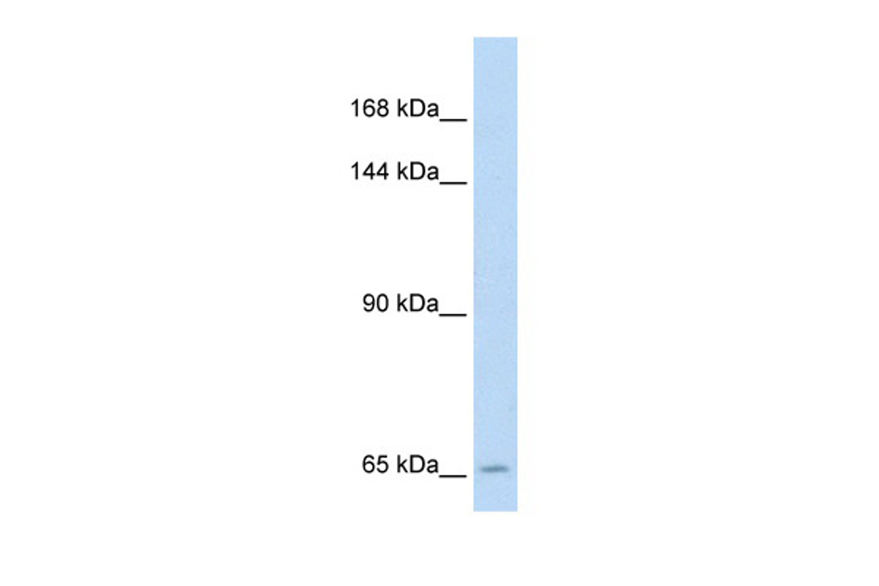 Antibody used in WB on Human Jurkat cells at 5.0 ug/ml.