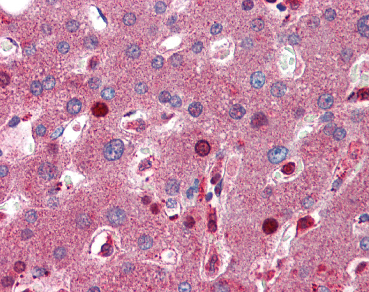 Antibody used in IHC on Human Liver.