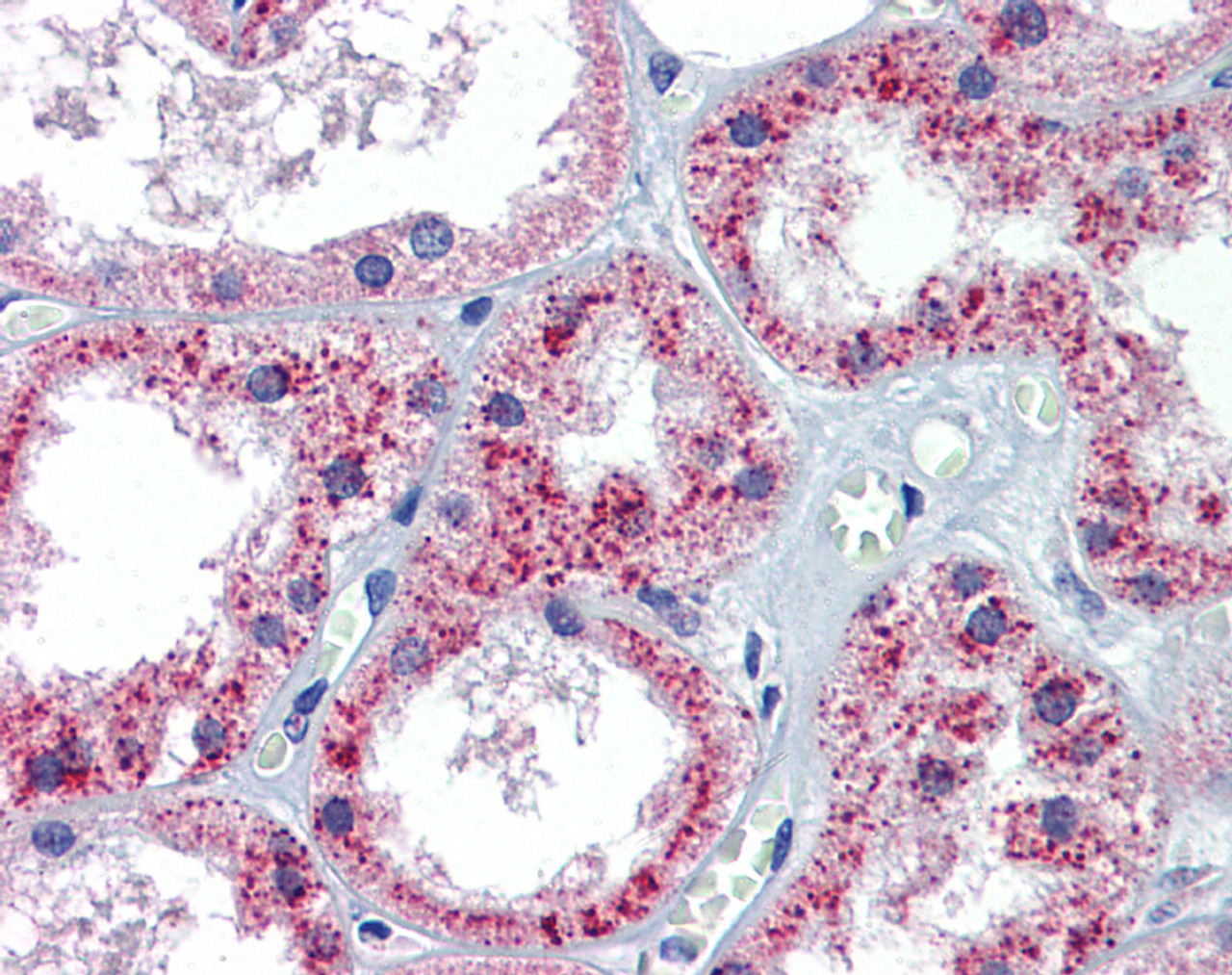 Antibody used in IHC on Human Kidney.