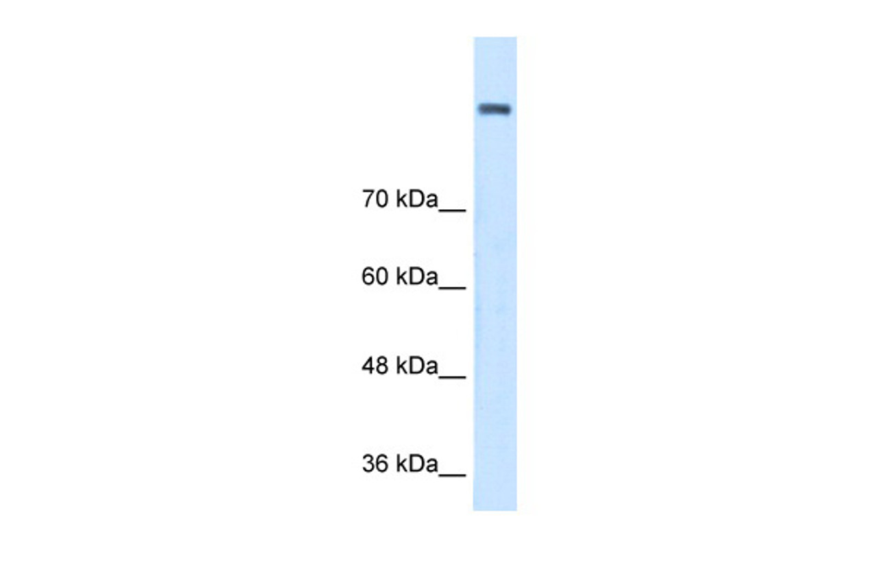 Antibody used in WB on Human Jurkat 0.2-1 ug/ml.