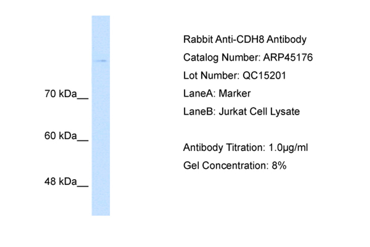 Antibody used in WB on Human Jurkat 1 ug/ml.