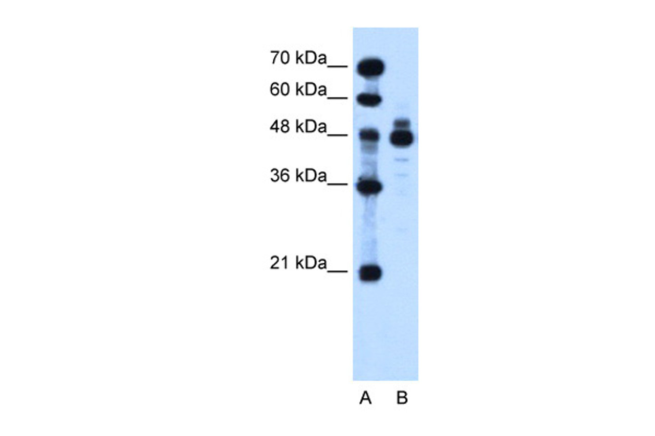 Antibody used in WB on Human HepG2 at 1.25 ug/ml.