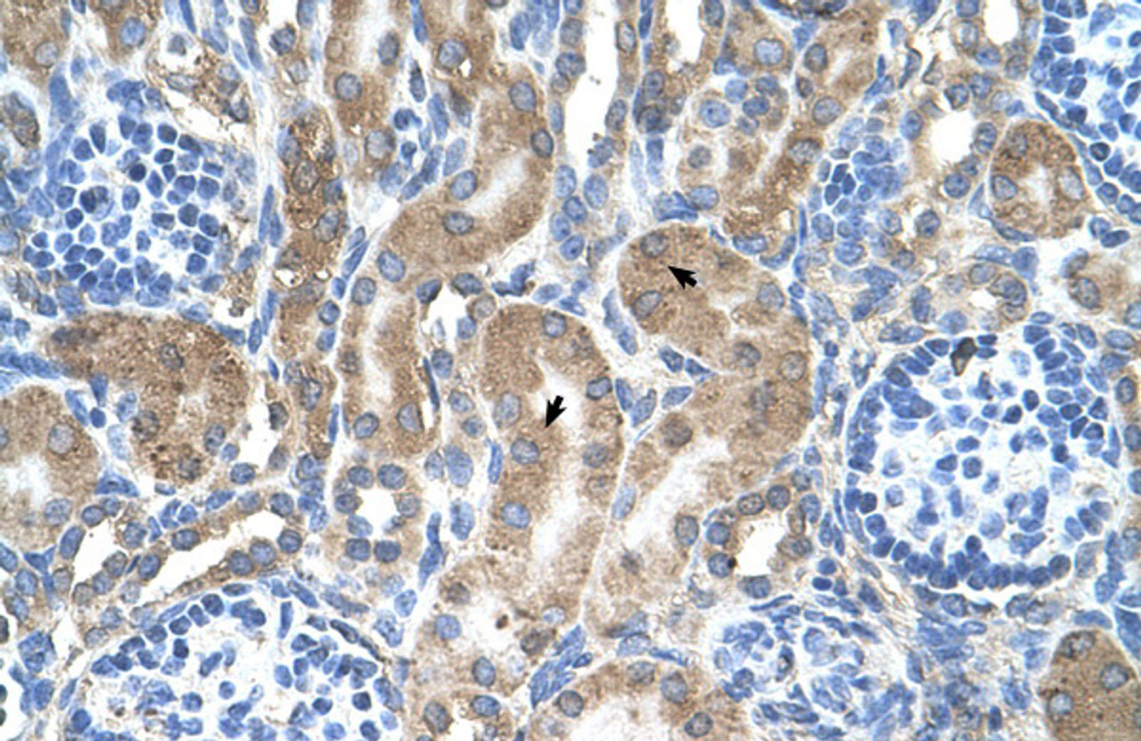 Antibody used in IHC on Human kidney.