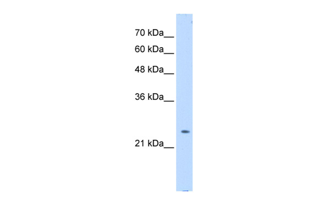 Antibody used in WB on Transfected 293T at 0.2-1 ug/ml.